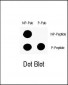 Phospho-P53(S9) Antibody