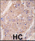 UVRAG Antibody (Center)