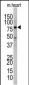 UVRAG Antibody (Center)