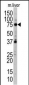 UVRAG Antibody (L133)