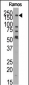 JMJD1B Antibody (N-term)