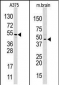 HIF1AN Antibody (C-term)