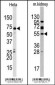 JMJD4 Antibody (C-term)