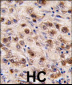 MINA Antibody (C-term)