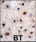 JMJD3 Antibody (N-term)