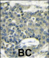 EIF4B Antibody (C-term)