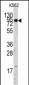 EIF4B Antibody (C-term)