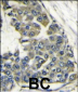 EIF4B Antibody (Center)