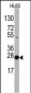 EIF4E Antibody (N-term)