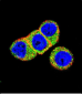 AKT2 Antibody (N-term)