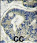 AKT2 Antibody (N-term)