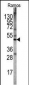 STK11 (LKB1) Antibody (N-term V34)