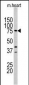 Lactoferrin (LTF) Antibody (Center)