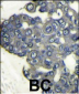 PI3KCD Antibody (N-term)