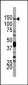 PI3KCD Antibody (N-term)