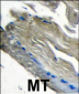 PIK3CG Antibody (C-term)