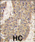 CASP6 Antibody (C-term)