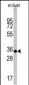 CASP6 Antibody (C-term)