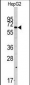 SWAP70 Antibody (Center)