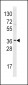 HNMT Antibody (N-term)