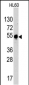 MYT1 Antibody (C-term)