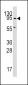 Dnmt3A/Dnmt3A2 Antibody (C-term)