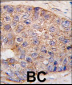 UBTD1 Antibody (C-term G195)
