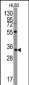 UBTD1 Antibody (C-term G195)