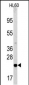 Bad Antibody (Center)