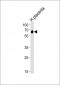 SPAK (STK39) Antibody (C-term)