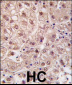 PSMA5 Antibody (N-term)