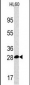 PSMA5 Antibody (Center)