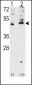 VEGFC (VEGF3) Antibody (Center M263)