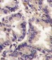 VEGFC (VEGF3) Antibody (Center M263)
