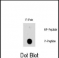 Phospho-HSPB1(S78) Antibody