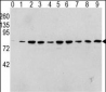 Phospho-RAF1(S338) Antibody