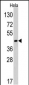 RAD9 Antibody (Center L265)