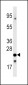 FXN Antibody (C-term)