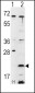 FXN Antibody (C-term)