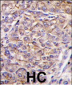 JIK (TAOK3) Antibody (C-term)