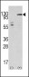 JIK (TAOK3) Antibody (C-term)