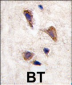 CAMKK2 Antibody (C-term)