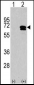 CAMKK2 Antibody (C-term)