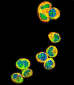 AKT1 Antibody (N-term)