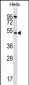 AKT1 Antibody (N-term)