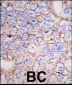 MAPK15 Antibody (N-term)