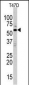 MAPK15 Antibody (N-term)