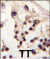TESK2 Antibody (Center C225)