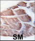 RSK2 (RPS6KA3) Antibody (N-term)