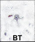PIK3R2 Antibody (N-term)